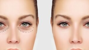 دراسة طب التجميل في مصر