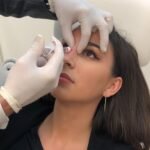 دبلومة التجميل والليزر للصيادلة