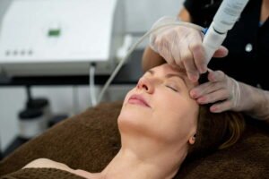 laser for skin